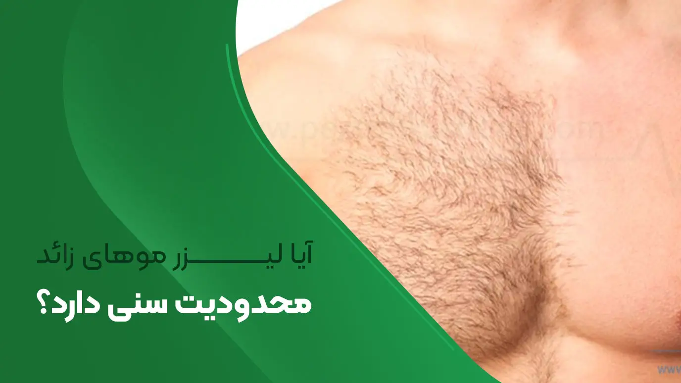 لیزر موهای زائد محدودیت سنی دارد؟