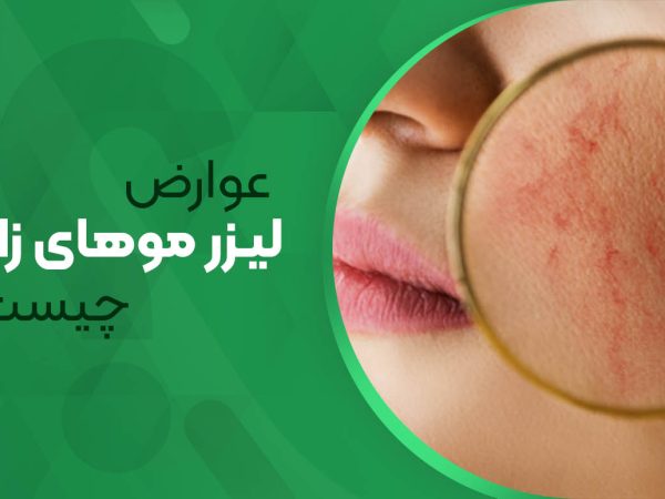 عوارض لیزر موهای زائد چیست