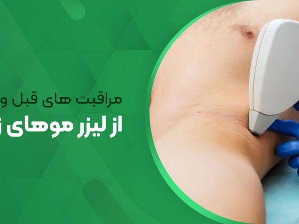مراقبت های قبل و بعد از لیزر موهای زائد