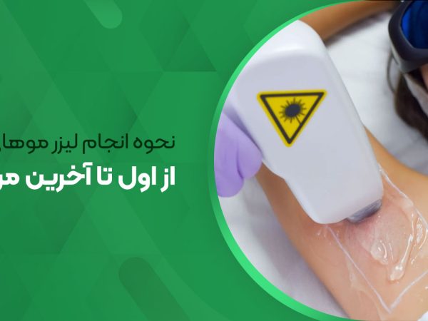 نحوه انجام لیزر موهای زائد از اول تا آخرین مرحله