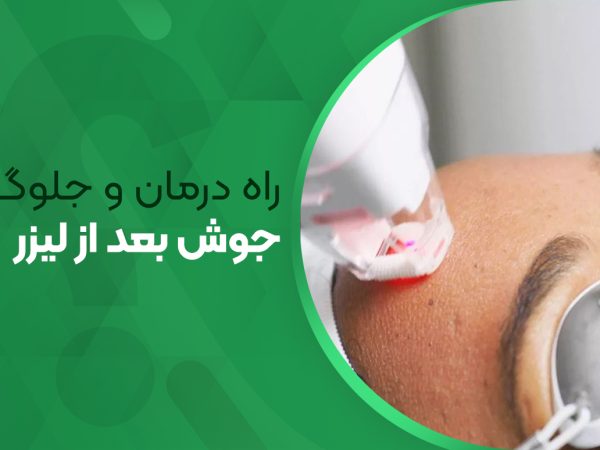 راه درمان و جلوگیری از جوش بعد از لیزر موهای زائد
