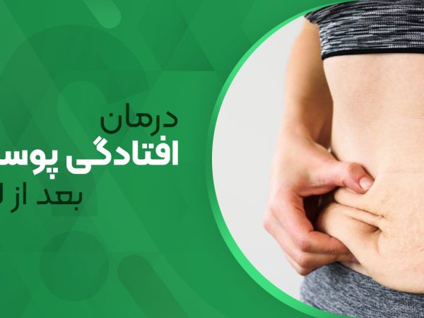 درمان افتادگی پوست بعد از لاغری