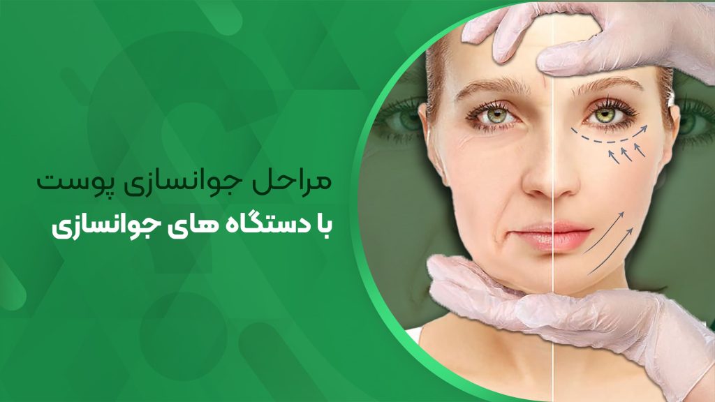 مراحل جوانسازی پوست با دستگاه های جوانسازی