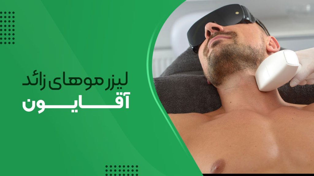 لیزر موهای زائد برای مردان