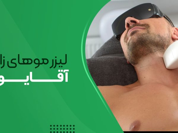لیزر موهای زائد برای مردان