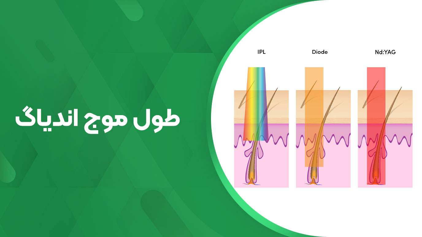 تصویر طول موج اندیاگ