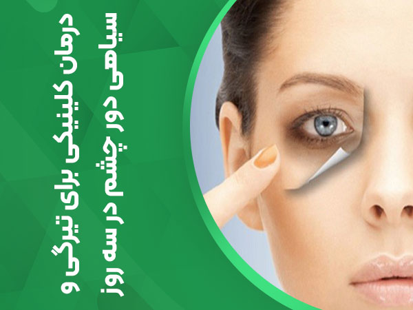 درمان کلینیکی برای تیرگی و سیاهی دور چشم در سه روز