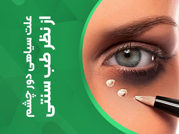 علت سیاهی دور چشم از نظر طب سنتی