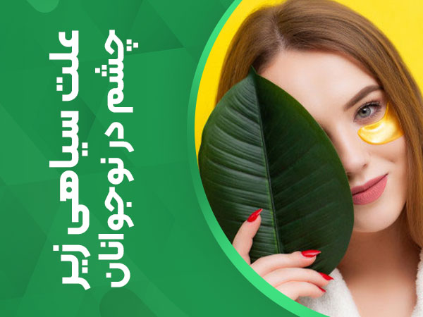 علت سیاهی زیر چشم در نوجوانان