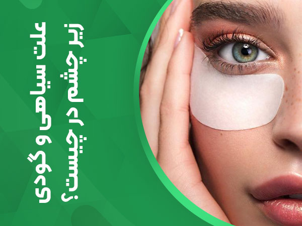 علت سیاهی و گودی زیر چشم در چیست؟