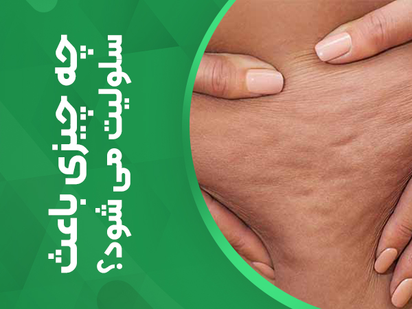 چه چیزی باعث سلولیت می شود؟ 