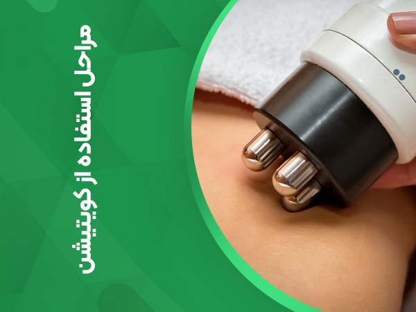 مراحل استفاده از کویتیشن
