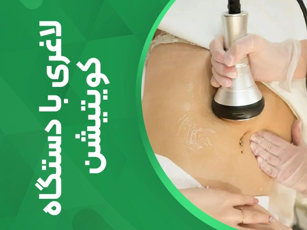 تصویر لاغری با دستگاه کویتیشن