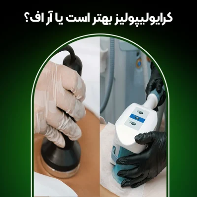 تصویر کرایولیپولیز بهتر است یا آر اف؟