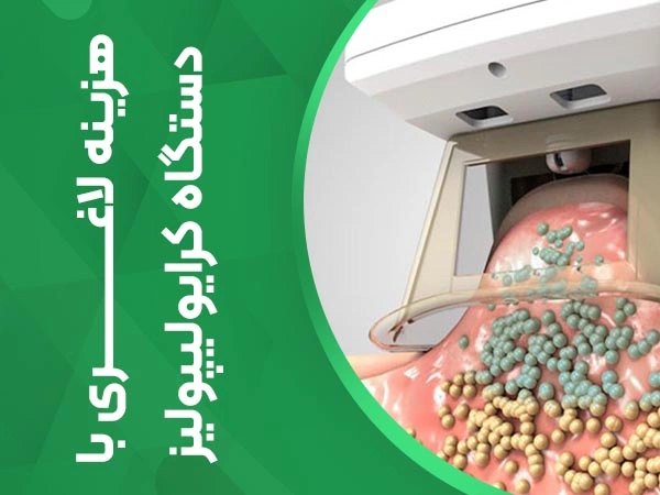 تصویر هزینه لاغری بادستگاه کرایولیپولیز