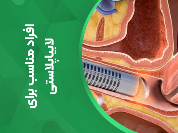 تصویر افراد مناسب برای عمل لابیاپلاستی