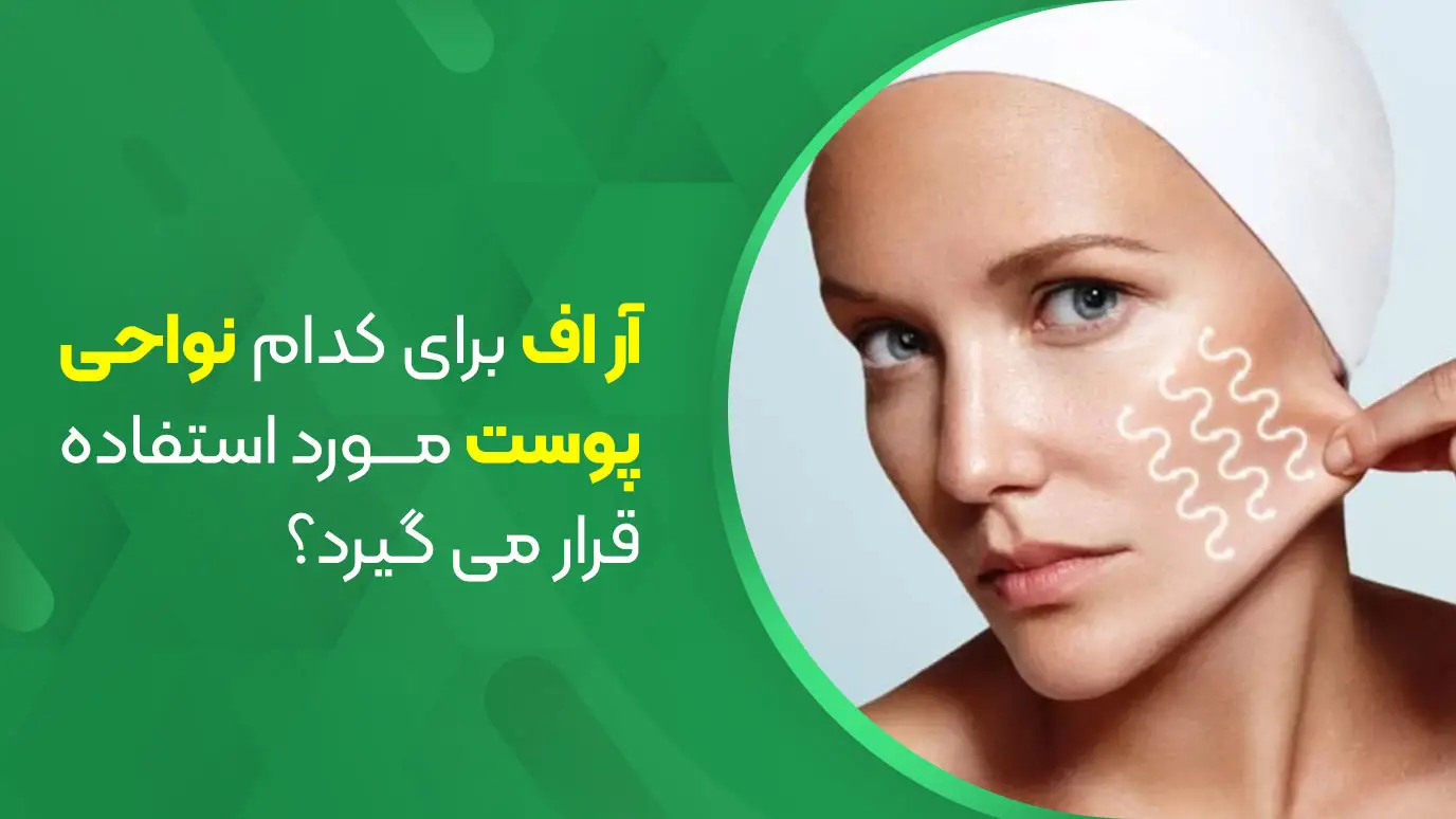 دستگاه آر اف برای کدام نواحی پوست مورد استفاده قرار میگیرد؟