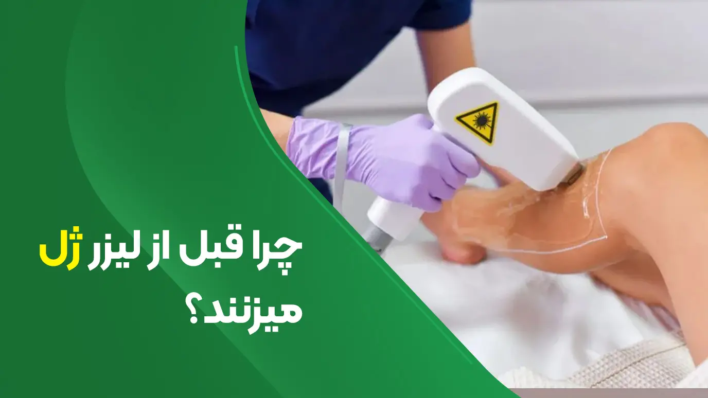 چرا قبل از لیزر ژل میزنند؟ 