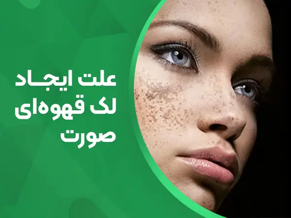 علت ایجاد لک قهوه ای صورت