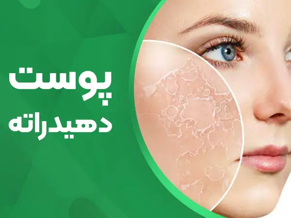 تصویر پوست دهیدراته