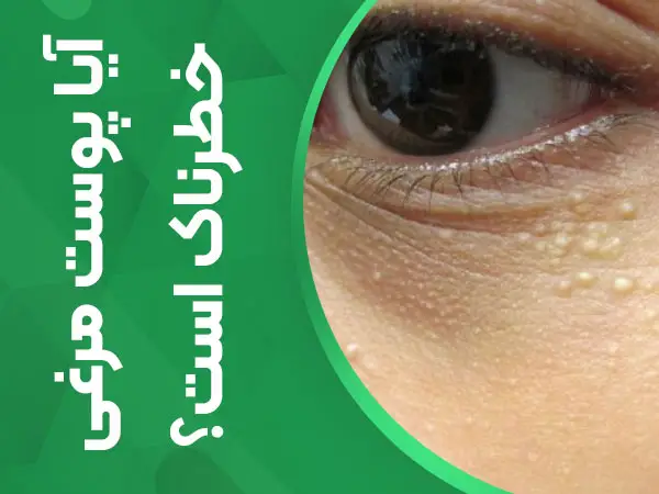 آیا پوست مرغی خطرناک است؟