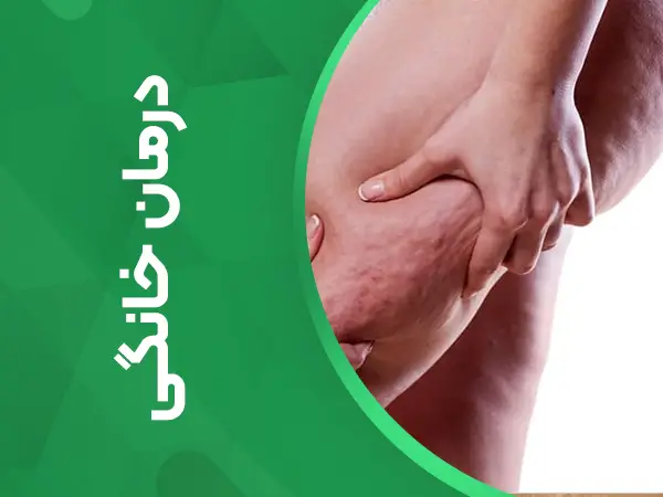 درمان خانگی