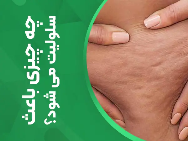 چه چیزی باعث سلولیت می شود؟