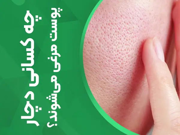چه کسانی دچار پوست مرغی می‌شوند؟