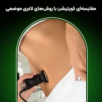 مقایسه کویتیشن یا دیگر روش ها